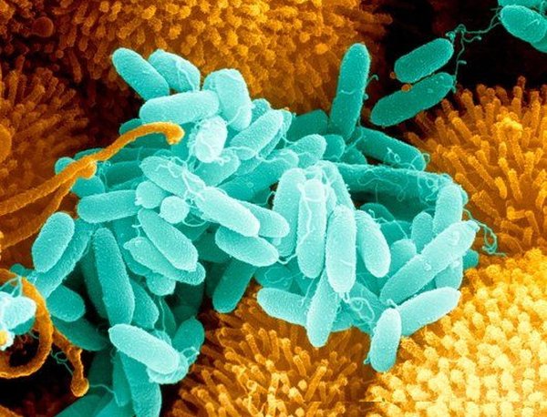 Синегнойная палочка – это подвижный микроб, который для своего развития нуждается в обязательном присутствии кислорода, отличается особой устойчивостью к большому числу противомикробных препаратов