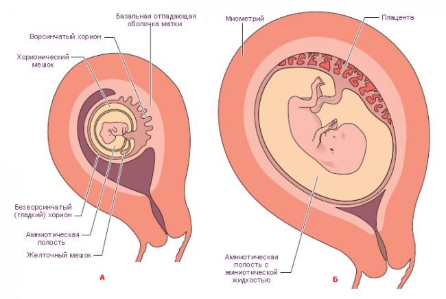Гематома в матке при беременности означает частичную отслойку плодного яйца и угрозу прерывания. Однако не стоит забывать о том, что лишние нервы могут лишь усугубить состояние