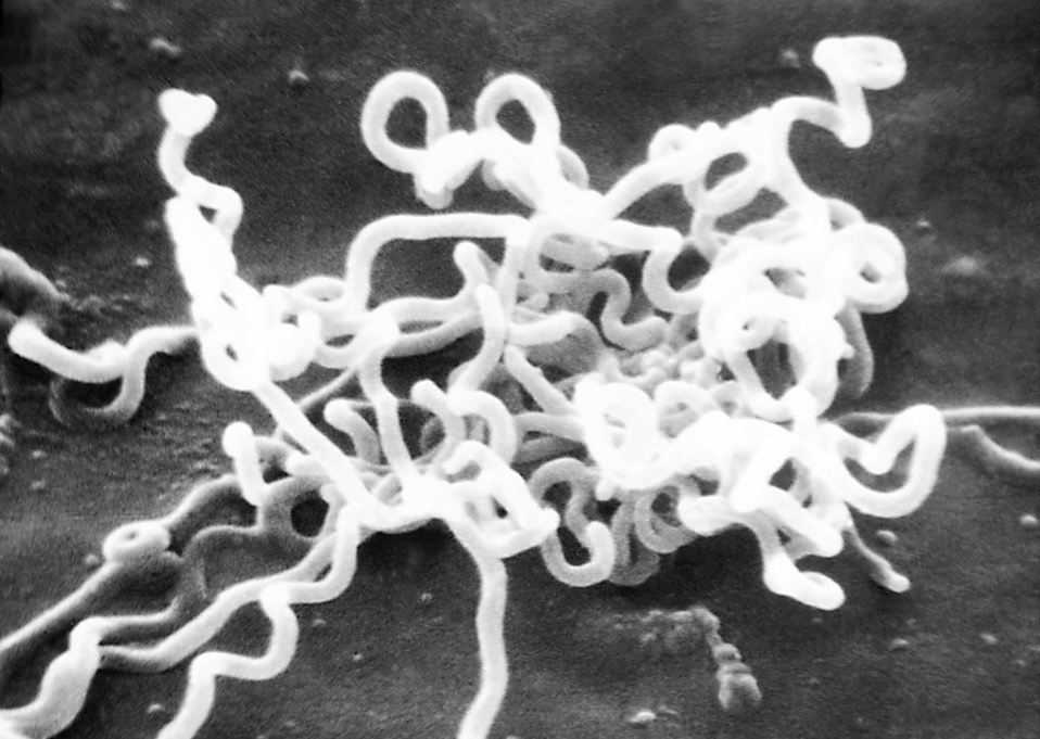 На фото показана под микроскопом бледная трепонема (Treponema pallidum) - возбудитель сифилиса.