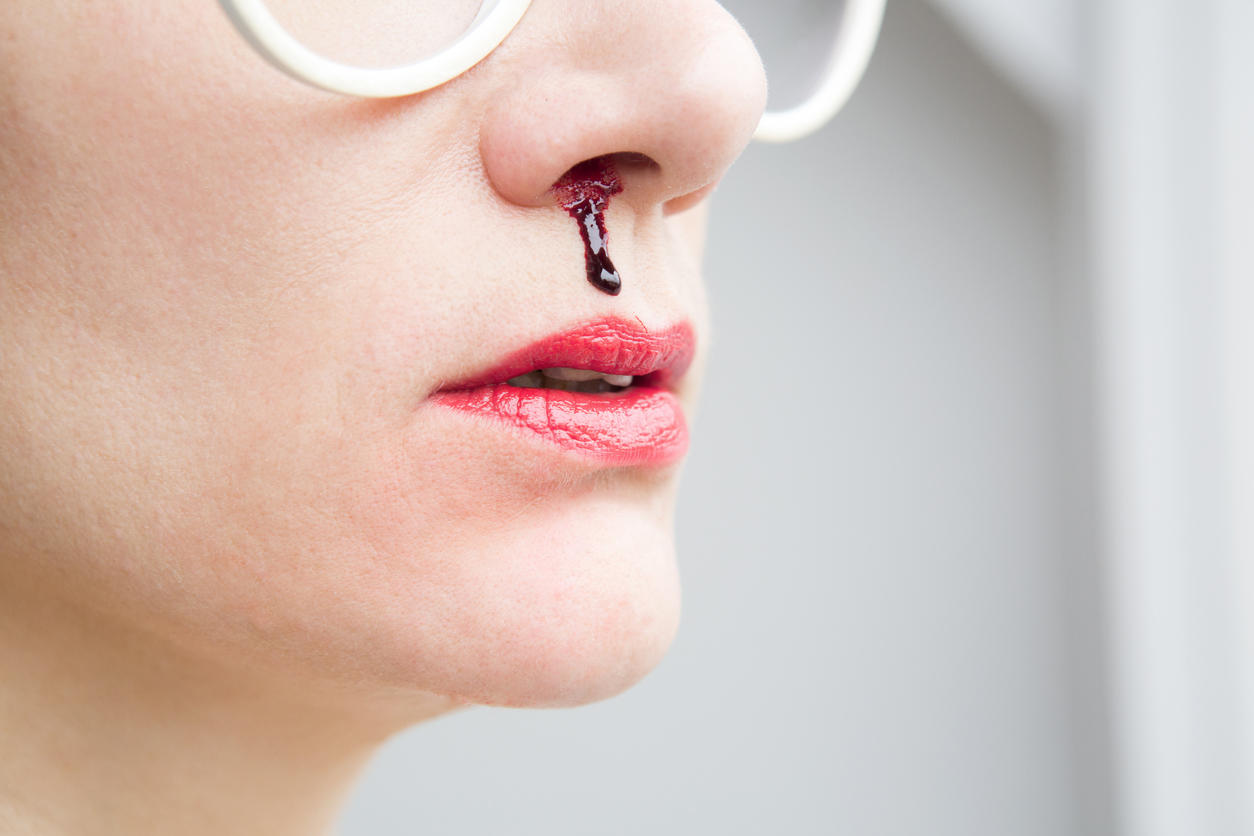 Частые носовые кровотечения - повод обратиться к гематологу