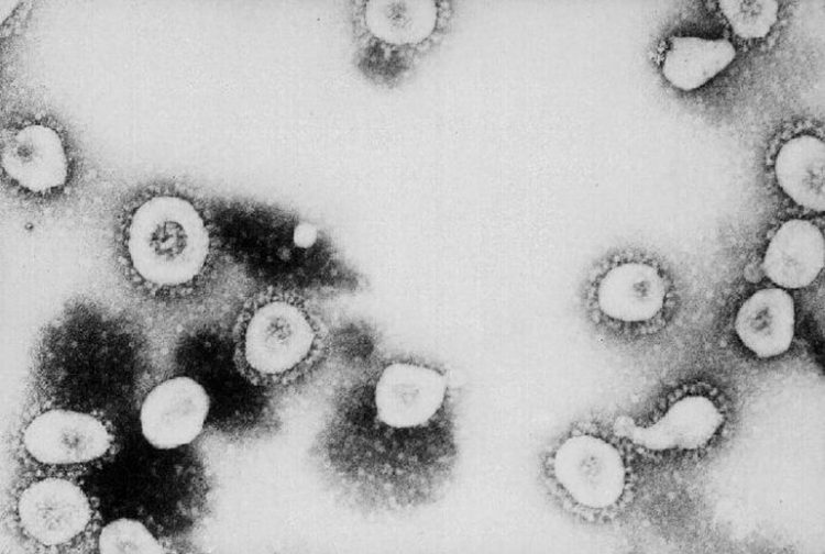 На фото показано как выглядит коронавирус под микроскопом, в натуральном, естественном виде.