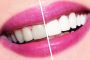 Отбеливание зубов дома самостоятельно, против профессиональных методов отбеливания
