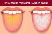 Желтый налет на языке: что это значит и когда стоит обратиться к врачу