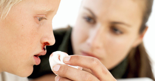 Для детей Аминокапроновая кислота применяется только когда имеется склонность к носовым кровотечениям и патологиям, сопровождаемым повышенной ломкостью капилляров