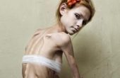 Анорексия (фото девушек) — симптомы, лечение, последствия