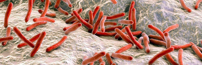Источником заражения бактерией является зараженный человек