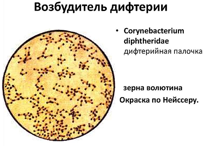 Бацилла Леффлера из рода коринебактерий - возбудитель дифтерии