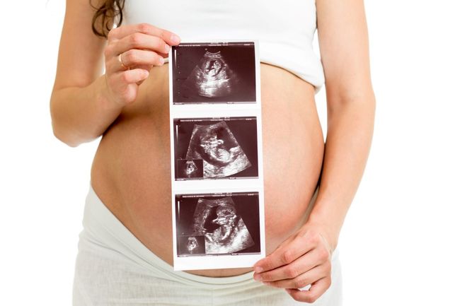 Допплерография должна проводиться как минимум 2 раза в ходе беременности.