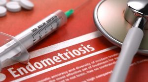 Последствий развития эндометриоза крайне многие: это и варианты со злокачественной опухолью, и серьезные гормональные нарушения, и внематочная беременность и другие не самые приятные последствия