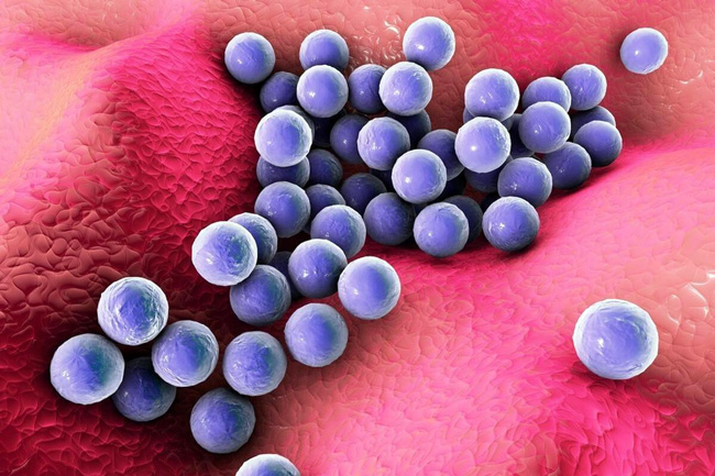 Staphylococcus aureus - возбудитель инфекционных заболеваний
