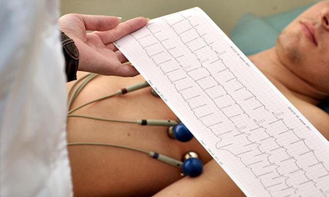 Диагностировать проблемы с сердцем и инфаркт миокарда можно при помощи ЭКГ