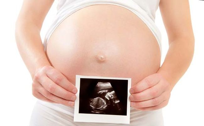 Фолликулярная киста яичника не мешает беременности