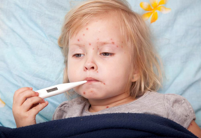 Вирус-возбудитель краснухи, способен навредить внутренним органам ребенка и серьёзно подорвать его иммунитет