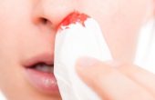 Кровь из носа у взрослого – почему это происходит и как остановить?