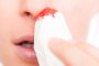 Кровь из носа у взрослого — почему это происходит и как остановить?