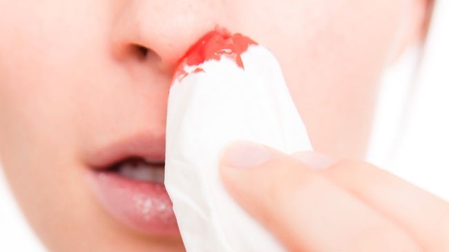 Одна из возможных причин носового кровотечения - недостаток витаминов