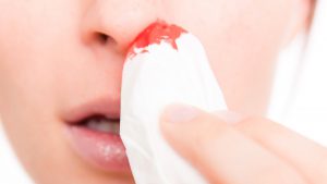 Крайне важно знать о возможных серьезных причинах носовых кровотечений у ребенка, чтобы оказать ему своевременную врачебную помощь