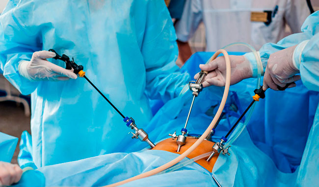 Лапароскопия относится к современному малоинвазивному виду оперативного лечения патологий внутренних органов