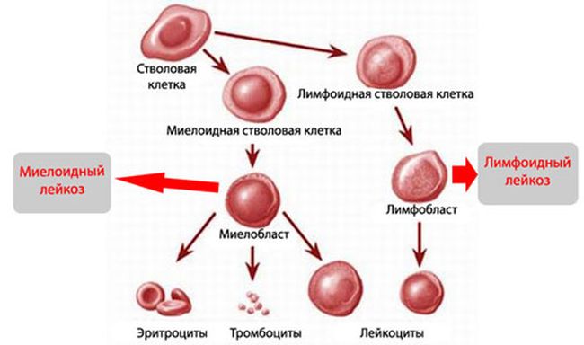 Миелоидный и лимфоидный лейкозы
