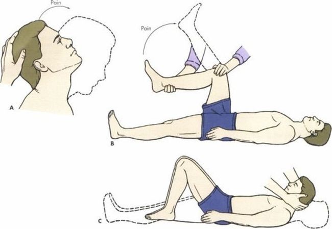 Cимптом Брудзинского - если голову больного в лежачем положении поднимают к груди, ноги сгибаются в тазобедренных и коленных суставах