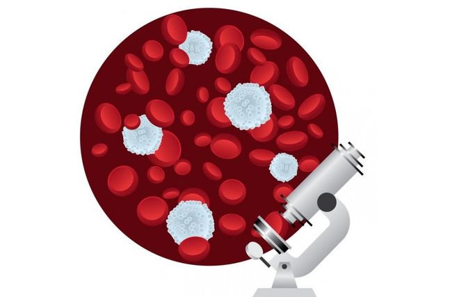 Лейкоциты - это один из важнейших лабораторных показателей в крови