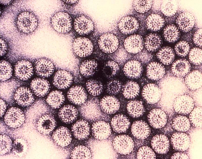 Отличить ротавирусную инфекцию от отравления самостоятельно весьма проблематично, поэтому при любых подозрительных симптомах рекомендуется обращаться за медицинской помощью