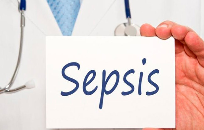Сепсис - это тяжёлое инфекционное заболевание, которое развивается как системная воспалительная реакция при попадании в кровь инфекционных агентов
