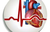 Причины возникновения синусового ритма сердца, симптомы и лечение