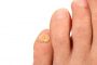 18 лучших средств от грибка ногтей – список препаратов, лазерная терапия и народная медицина против онихомикоза