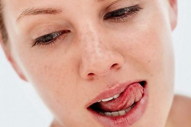 Жажда и сухость во рту - одни из главных симптомов сахарного диабета