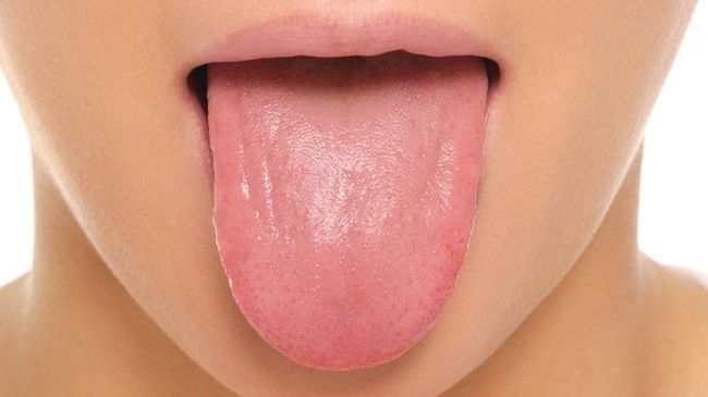 Еще один способ устранить сухость во рту - очищать полость рта фторосодержащими ополоскивателями