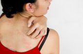 Сыпь на теле у взрослого (чешется и без зуда) – причины и чем лечить