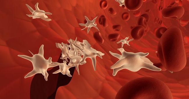 Если в кровеносном русле концентрация тромбоцитов снижается до 150 тысяч на 1 микролитр - у человека развивается болезнь тромбоцитопения