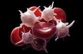 Повышен средний объем тромбоцитов в крови – какую болезнь это может означать? Симптомы и лечение отклонений от нормы тромбоцитов в крови