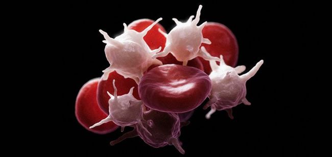 Узнать о повышении уровня тромбоцитов в крови можно только при помощи сдачи анализа крови