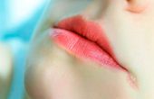 Заеды в уголках рта – от чего возникают и чем лечить?