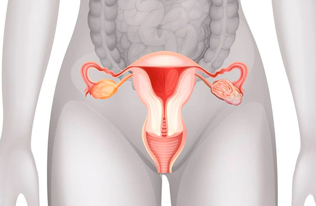 На сегодня загиб матки встречается практически у четверти женщин и девушек, данную патологию могут выявить при обычном осмотре и обследовании у гинеколога
