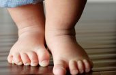 Вальгусная деформация стопы у детей — как вовремя заметить патологию? Причины и лечение болезни